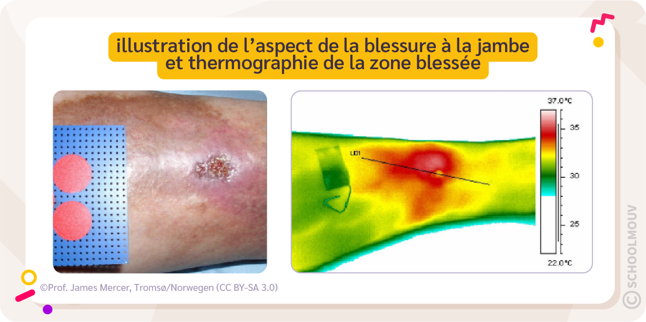 Des symptômes visibles suite à une inflammation causée par une blessure