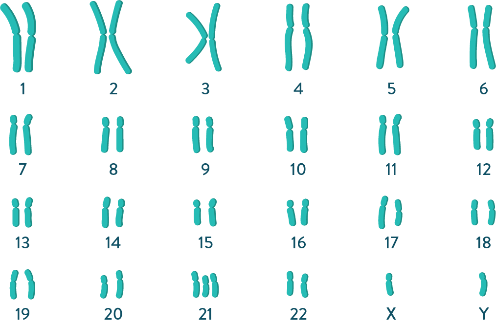 caryotype d’un individu atteint de trisomie 21