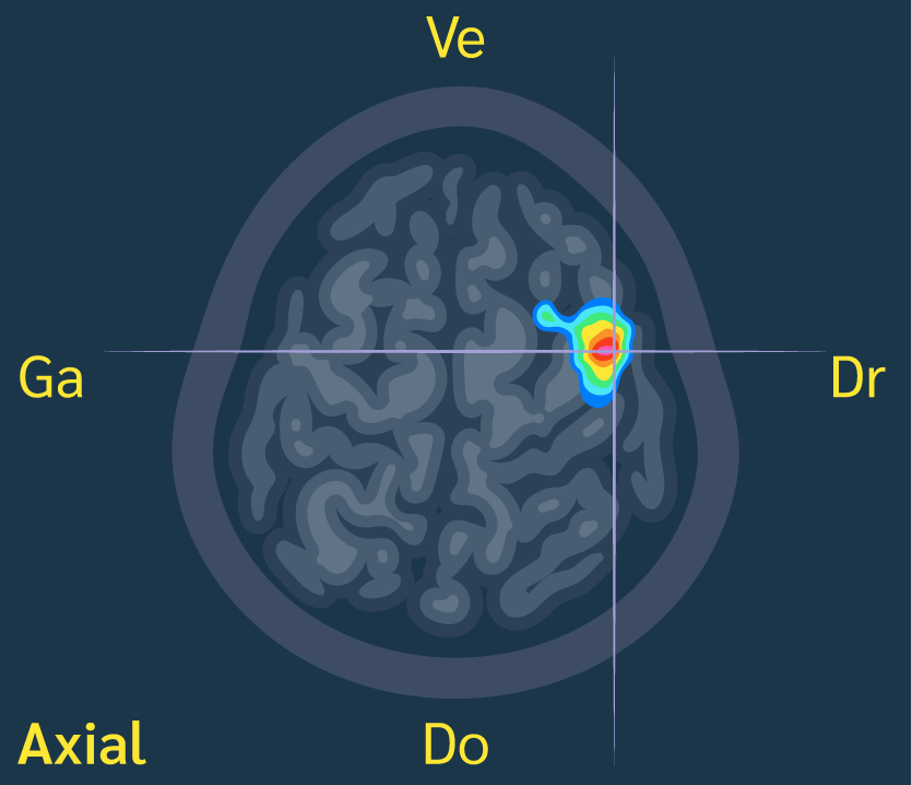 cerveau image hémisphère droit